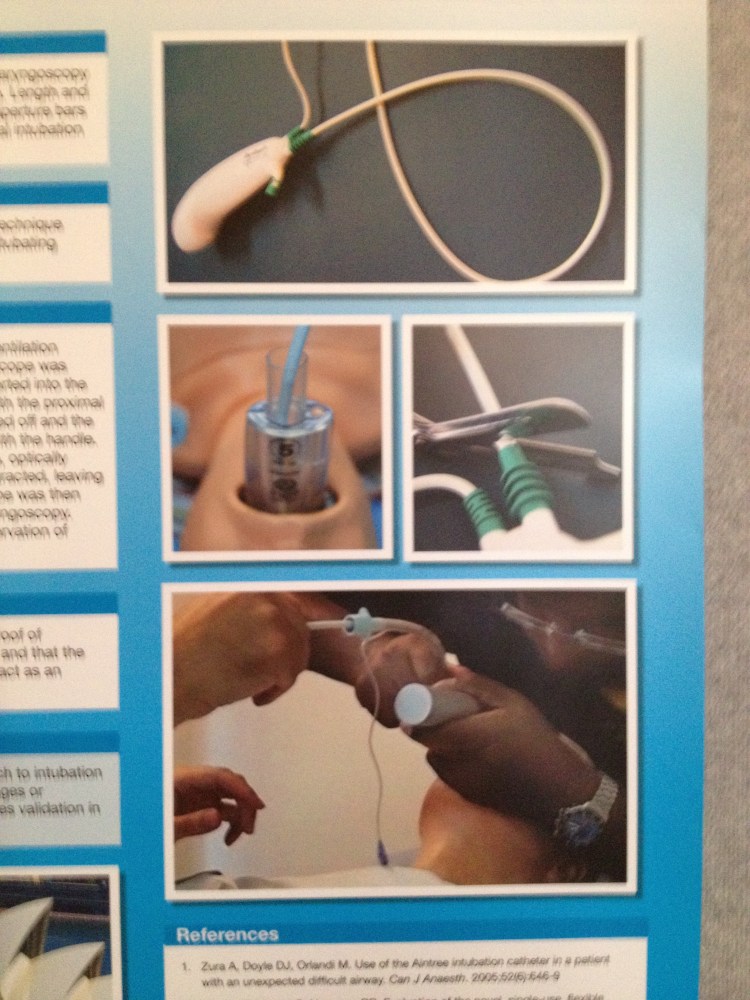 Scientific poster on the intubation technique developed by Cliff Reid and colleagues