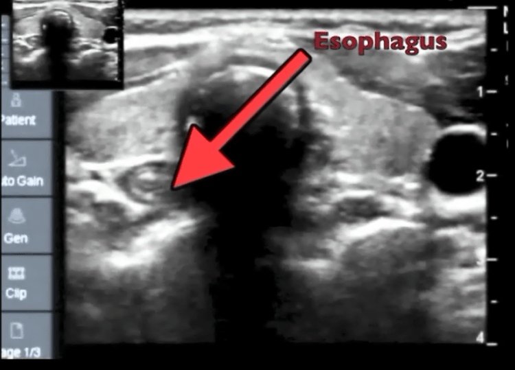 Still image taken from video available with the article