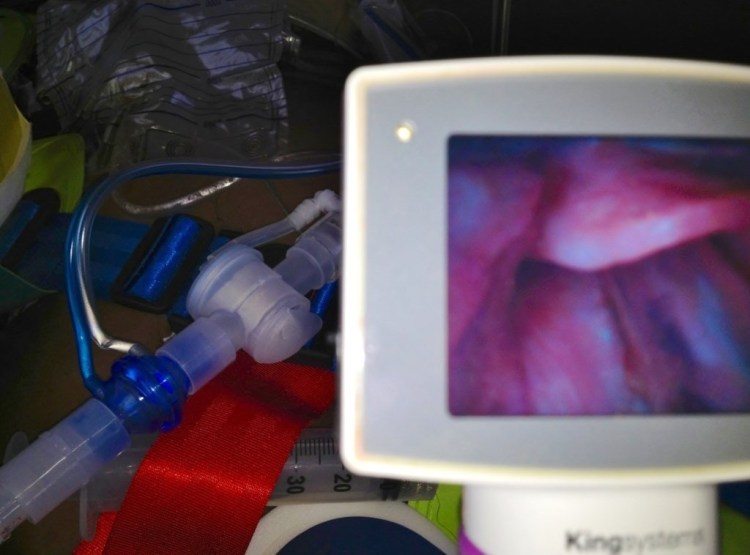 Here is an intubation we prepared earlier