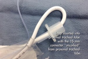 d-loop Pocket Bougie configuration